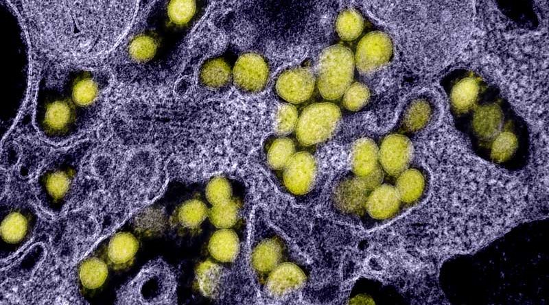 Disease detectives track an invisible virus